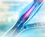 Restenosis Prevention