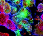 Screening for Inhibitors of the Anticancer Target and Ubiquitination Regulator CSN5 with an HTS Fluorescence Polarization Technique