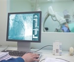What is Angiography?