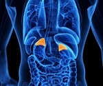Researchers uncover a surprising layer of complexity in aldosterone-producing tumors
