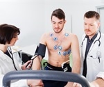 Stress Echocardiogram Procedure