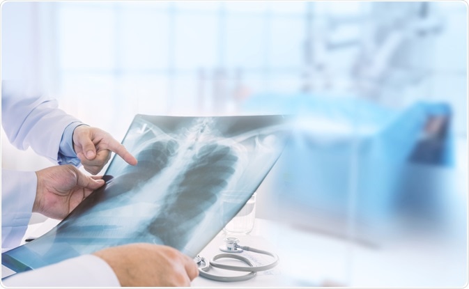Lung X-Ray