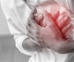 Atrial Remodeling for Atrial Fibrillation
