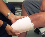 Amputations due to diabetes can be prevented