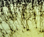 Scientists discover new mechanism behind Huntington’s disease brain cell death