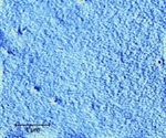 Imaging Hydrogel Coatings in Biomedical Applications