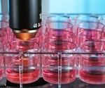 Stimulated Emission Depletion (STED) Microscopy