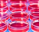 Investigating the role of ultra-processed foods in the inheritance of autism and ADHD