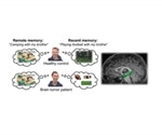 Radiation therapy impairs new memory formation in pediatric brain tumor patients