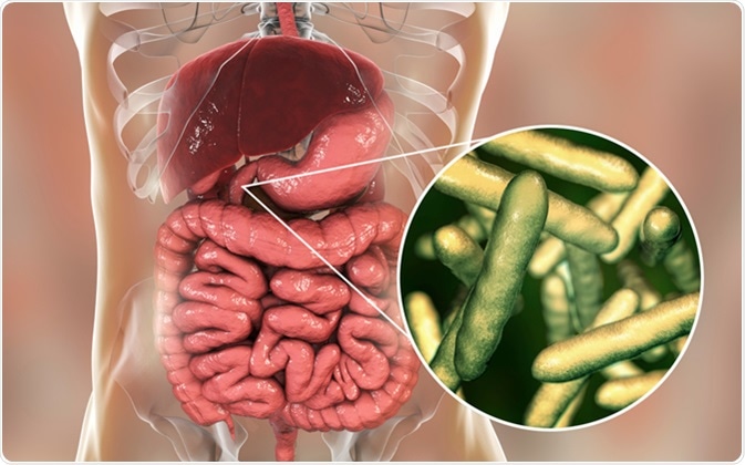 Tropheryma whipplei bacteria in human duodenum, the causative organism of Whipple