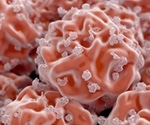 Recent Advancements in Stem Cell Treatments