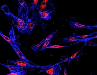'Two-in-one' RNA molecule can simultaneously turn off two difficult-to-target cancer-related genes