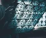 How Does the Suprachiasmatic Nucleus (SCN) Control Circadian Rhythm?