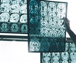Integrated PET/MR for Alzheimer’s Disease