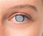 NR2F1 drives fibrotic cataract formation through activation of STAT3