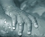 Second case of Monkeypox infection identified in UK