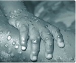 Third case of monkey pox confirmed in UK