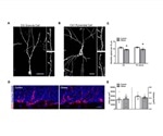 Obesity contributes to cognitive deficits by activating microglial cells, mice study shows