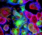 What is Neuroimmunology?