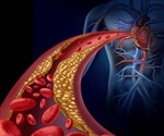 Blood Clotting Process