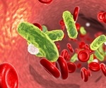 Sepsis Complications and Prevention