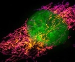 Structured Illumination Microscopy in Research