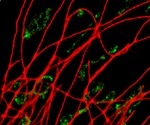Super-Resolution Imaging of Biological Specimens