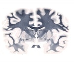 Advances in Whole Mount Brain Imaging