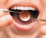 Diabetes and Periodontitis