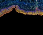 Multi-color Immunohistochemistry (IHC)