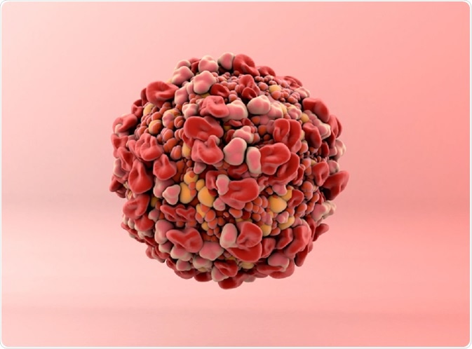 Tumor