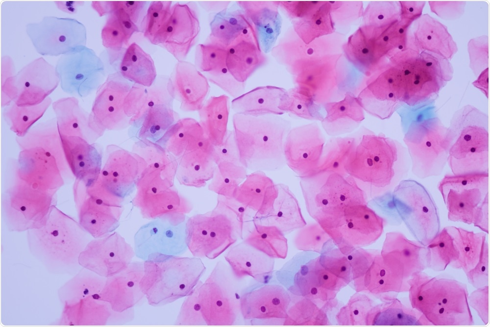 Pap Cytological (smear) test under the microscope - A photo taken by Komsan Loonprom
