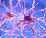 Amyloid Cascade Hypothesis