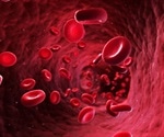 Anoxia Symptoms and Diagnosis