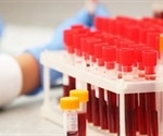 Losing Energy vs. Losing Samples, Trade-offs in Sample Storage