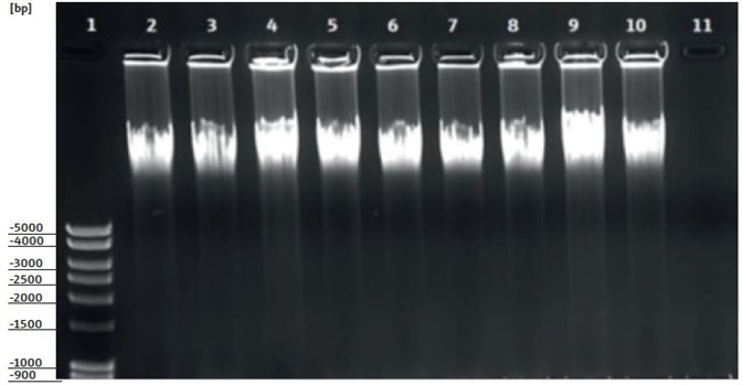 Results of horizontal agarose gel electrophoresis, gDNA from whole blood samples (pelleted nucleated cells), extracted by means of an automated process using smart Blood DNA Midi prep (a96) in combination with the CyBio® FeliX pipetting system. Visualized is a used quantity of 10 μl of eluate on a 0.8 % agarose gel with added ethidium bromide. Column 1: DNA ladder; Columns 2 – 10: DNA extracted from nucleus containing cells from 3 ml whole blood; Column 11 : negative control (CO)