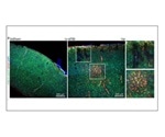 Researchers identify how concussions may contribute to seizures