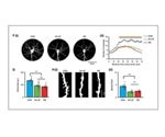 Developmental dysfunction of prefrontal cortex causes cognitive deficits related to mental illness