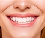 Universal Numbering System for Teeth