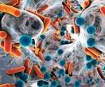Biofilm Analysis: Tools and Techniques