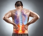 Foods that Drive Inflammation
