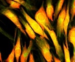 Confocal Versus Super-resolution Microscopy