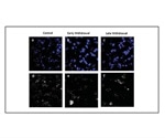 Diabetes drug abolishes characteristic signs of nicotine withdrawal in mice