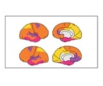 Functional connectome of fetal brain begins to take form in utero