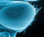 Advantages and Disadvantages of Electron Microscopy