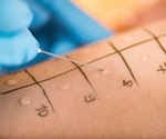Can Food Allergies Ever be Psychological?