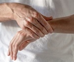 Does Drinking Alcohol Cause Joint Pain in Arthritis?