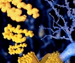 Using iPSC Techniques to Study Genetics, Mechanisms & Treatments of Neurodegenerative Disorders