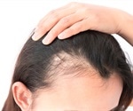 Air pollution may be causing your hair to fall out