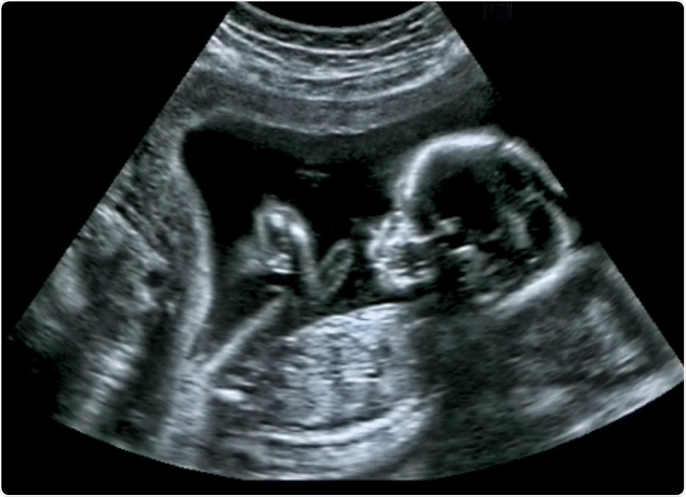 baby in natural womb